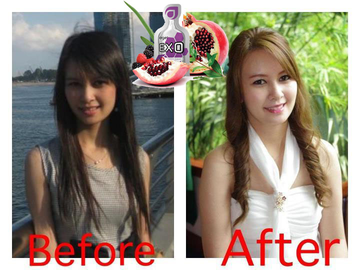 exo-beforeafter